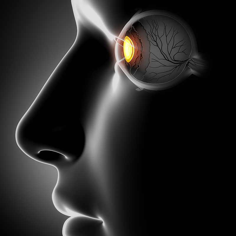 distacco-retina
