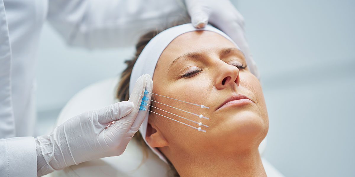 Lifting Viso Cosa Sono I Fili Di Trazione BDXQV